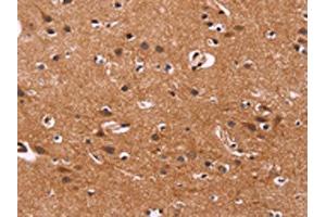 The image on the left is immunohistochemistry of paraffin-embedded Human brain tissue using ABIN7128511(ARL4A Antibody) at dilution 1/50, on the right is treated with fusion protein. (ARL4A anticorps)