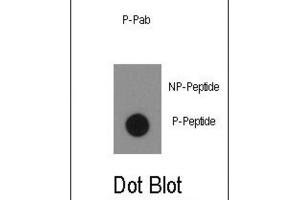Dot Blot (DB) image for anti-C-Abl Oncogene 1, Non-Receptor tyrosine Kinase (ABL1) (pTyr134) antibody (ABIN3001743) (ABL1 anticorps  (pTyr134))