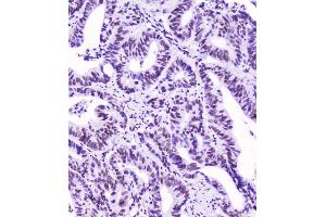 IHC analysis of SMC3 using anti-SMC3 antibody (ABIN5693037).
