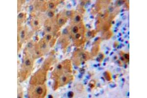 Used in DAB staining on fromalin fixed paraffin-embedded Liver tissue (IL16 anticorps  (AA 1203-1322))
