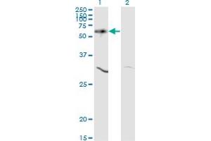 Western Blot analysis of AKT1 expression in transfected 293T cell line by AKT1 monoclonal antibody (M03), clone 2E11.