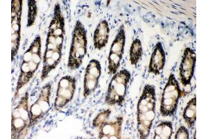 Anti- MSH2 Picoband antibody, IHC(P) IHC(P): Rat Intestine Tissue