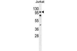 CWC22 Antibody (N-term) western blot analysis in Jurkat cell line lysates (35µg/lane). (CWC22 anticorps  (N-Term))