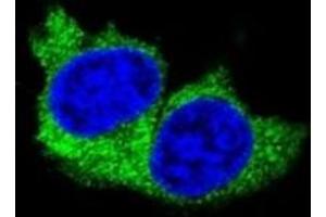 Confocal immunofluorescent analysis of MMP1 antibody with MDA-MB231 cells followed by Alexa Fluor 488-conjugated goat anti-rabbit lgG (green).