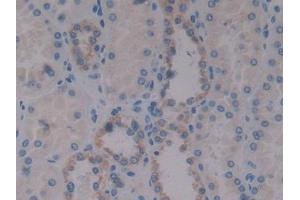 DAB staining on IHC-P; Samples: Human Kidney Tissue (Insulin Like Protein 3 (AA 2-129) anticorps)