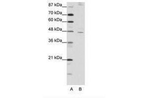 Image no. 1 for anti-Nuclear Receptor Subfamily 2, Group F, Member 2 (NR2F2) (AA 311-360) antibody (ABIN202470) (NR2F2 anticorps  (AA 311-360))