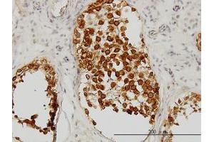 Image no. 1 for anti-Deleted in Azoospermia 1 (DAZ1) (AA 21-121) antibody (ABIN598640) (DAZ1 anticorps  (AA 21-121))