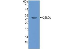 Detection of Recombinant CENPF, Human using Polyclonal Antibody to Centromere Protein F (CENPF) (CENPF anticorps  (AA 436-637))
