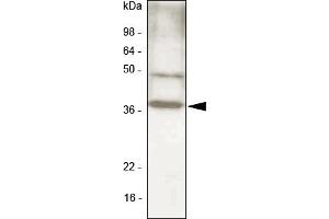 Western blot analysis.