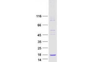 Validation with Western Blot