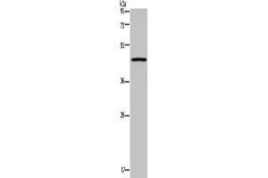 Gel: 8 % SDS-PAGE, Lysate: 40 μg, Lane: Mouse lung tissue, Primary antibody: ABIN7130211(MECP2 Antibody) at dilution 1/300, Secondary antibody: Goat anti rabbit IgG at 1/8000 dilution, Exposure time: 3 minutes (MECP2 anticorps)