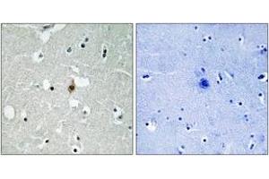 Immunohistochemistry analysis of paraffin-embedded human brain tissue, using E2A (Ab-355) Antibody. (TCF3 anticorps  (AA 321-370))