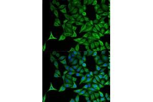 Immunofluorescence analysis of HeLa cells using KRT20 antibody. (KRT20 anticorps  (AA 245-424))