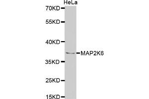 Western blot analysis of extracts of HeLa cells, using MAP2K6 antibody. (MAP2K6 anticorps)