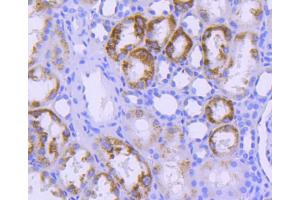 Paraformaldehyde-fixed, paraffin embedded human kidney, Antigen retrieval by boiling in sodium citrate buffer (pH6) for 15min, Block endogenous peroxidase by 3% hydrogen peroxide for 30 minutes, Blocking buffer at 37°C for 20min, Antibody incubation with STAT6 (9A7) Monoclonal Antibody at 1:50 overnight at 4°C, followed by a conjugated secondary and DAB staining.