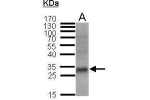 WB Image Sample (50 ug of whole cell lysate) A: CCRF-SB 12% SDS PAGE antibody diluted at 1:1000