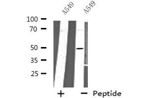 Western blot analysis of extracts from A549 cells using CHRNA10 antibody. (CHRNA10 anticorps  (C-Term))