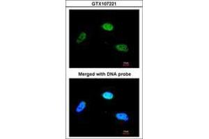 Image no. 1 for anti-Zinc Finger Protein 398 (ZNF398) (AA 358-630) antibody (ABIN467495)
