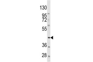 Western blot analysis of PDGFRL antibody and HeLa lysate. (PDGFRL anticorps  (AA 328-357))