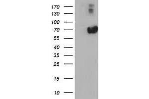 Western Blotting (WB) image for anti-alpha-Fetoprotein (AFP) antibody (ABIN1496489) (alpha Fetoprotein anticorps)