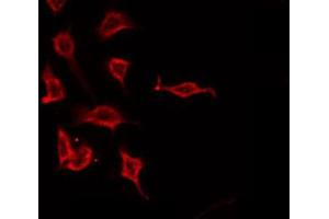 ABIN6266613 staining A549 by IF/ICC.