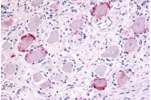 Anti-TRPA1 antibody  ABIN1049431 IHC staining of human ganglion cells. (TRPA1 anticorps  (Internal Region))