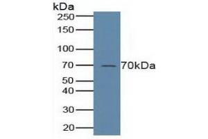 Figure. (ALOX5 anticorps  (AA 461-671))