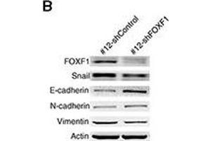 FOXF1 mediates reprogramming effects on fusion progeny(A) FOXF1 mRNA levels were determined by real-time PCR in fusion progeny and parent cell lines. (Vimentin anticorps)