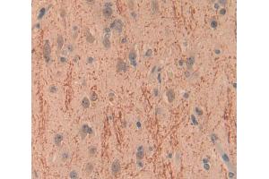 Used in DAB staining on fromalin fixed paraffin- embedded Kidney tissue (BCR anticorps  (AA 1042-1243))