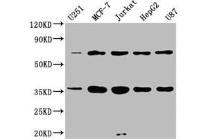 Western Blot Positive WB detected in: U251 whole cell lysate, MCF-7 whole cell lysate, Jurkat whole cell lysate, HepG2 whole cell lysate, U87 whole cell lysate All lanes: SHOC2 antibody at 1:2000 Secondary Goat polyclonal to rabbit IgG at 1/50000 dilution Predicted band size: 65, 60 kDa Observed band size: 65 kDa