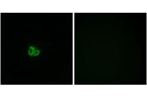Immunofluorescence analysis of COS7 cells, using Stathmin 1 (Phospho-Ser15) Antibody.