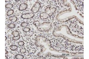 Image no. 1 for anti-TATA Box Binding Protein Associated Factor 11 (TAF11) (AA 158-211) antibody (ABIN598958) (TAF11 anticorps  (AA 158-211))