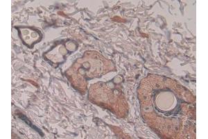 IHC-P analysis of Rat Skin Tissue, with DAB staining. (Pronociceptin (AA 12-181) anticorps)