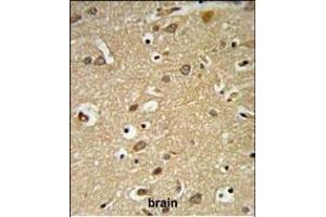 IGF1R Antibody (N-term K66) (ABIN652374 and ABIN2841778) IHC analysis in formalin fixed and paraffin embedded brain tissue followed by peroxidase conjugation of the secondary antibody and DAB staining.