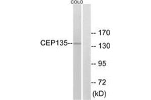 Western blot analysis of extracts from COLO cells, using CEP135 Antibody. (CEP135 anticorps  (AA 1081-1130))
