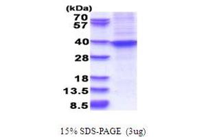 SDS-PAGE (SDS) image for Homeobox A9 (HOXA9) (AA 1-272) protein (His tag) (ABIN5853687)