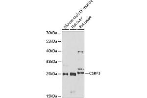 Western blot analysis of extracts of various cell lines, using CSRP3 antibody (ABIN6129258, ABIN6139141, ABIN6139143 and ABIN6222244) at 1:1000 dilution. (CSRP3 anticorps  (AA 1-194))