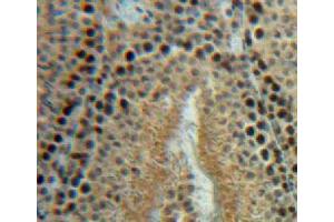 Used in DAB staining on fromalin fixed paraffin-embedded testis tissue (HSPH1 anticorps  (AA 595-733))