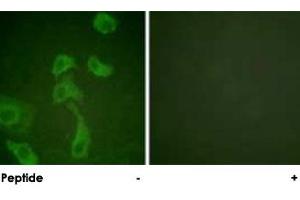 Immunofluorescence analysis of HeLa cells, using IL2RB polyclonal antibody . (IL2 Receptor beta anticorps)