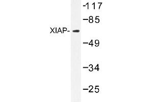 Image no. 1 for anti-X-Linked Inhibitor of Apoptosis (XIAP) antibody (ABIN272094) (XIAP anticorps)