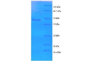 Troponin I Type 3 (Cardiac) (TNNI3) (AA 1-146), (partial) protein (GST tag)