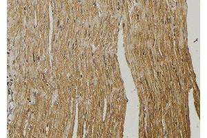 ABIN6272949 at 1/100 staining Mouse muscle tissue by IHC-P. (RDH10 anticorps  (Internal Region))