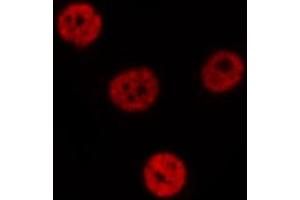 ABIN6275418 staining  NIH-3T3 cells by IF/ICC. (S100A16 anticorps  (Internal Region))