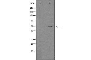 Western blot analysis of K562 whole cell lysates, using TNFRSF11B  Antibody. (Osteoprotegerin anticorps  (Internal Region))