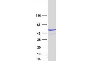 Validation with Western Blot