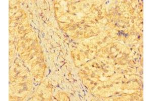 Immunohistochemistry of paraffin-embedded human adrenal gland tissue using ABIN7157336 at dilution of 1:100 (KRTAP23-1 anticorps  (AA 1-65))