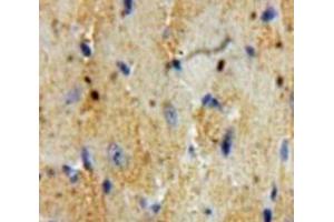 IHC-P analysis of Heart tissue, with DAB staining. (Cardiac Troponin T2 anticorps  (AA 2-100))