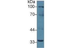 Western Blot; Sample: Mouse Liver lysate; Primary Ab: 2µg/ml Rabbit Anti-Mouse RANk Antibody Second Ab: 0. (TNFRSF11A anticorps  (AA 359-542))