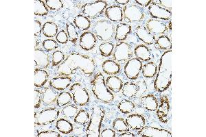 Immunohistochemistry of paraffin-embedded rat kidney using VEGFB Rabbit pAb (ABIN6128909, ABIN6150090, ABIN6150092 and ABIN6216417) at dilution of 1:150 (40x lens).