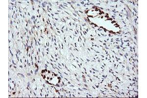 Image no. 1 for anti-ERG, ETS transcription factor (ERG) antibody (ABIN1498076)